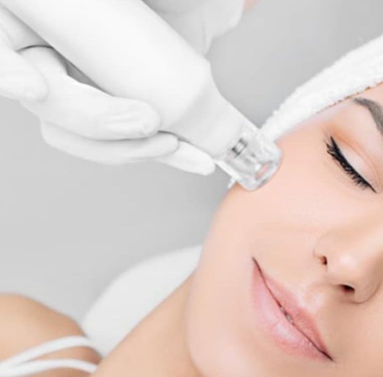 dermaplaning north epping