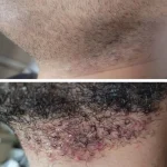 dermatological skincare