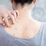 laser hair removal beecroft