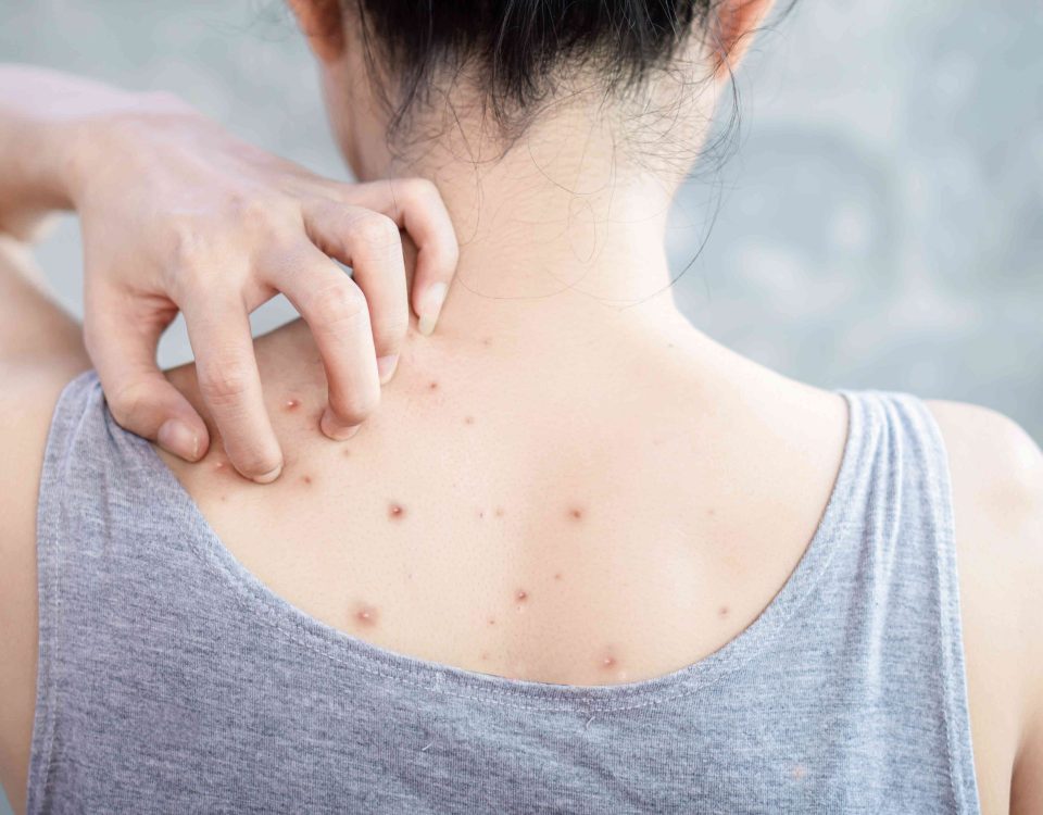 laser hair removal beecroft