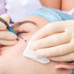 skin tags removal cheltenham